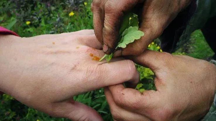 schoellkraut gegen warzen hand 738